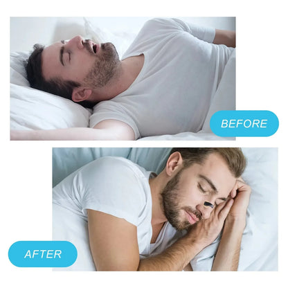 Nasal Breathing Dilators Starter Kit Magnetic Nasal Strips Nose Tabs Sleep and Sports Increase Air Intake Reduce Snoring Device
